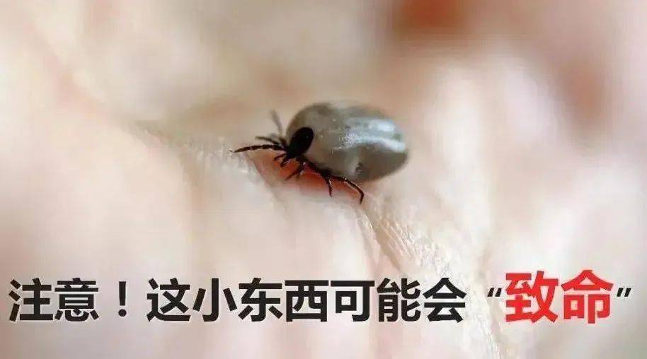 電子體溫計(jì)